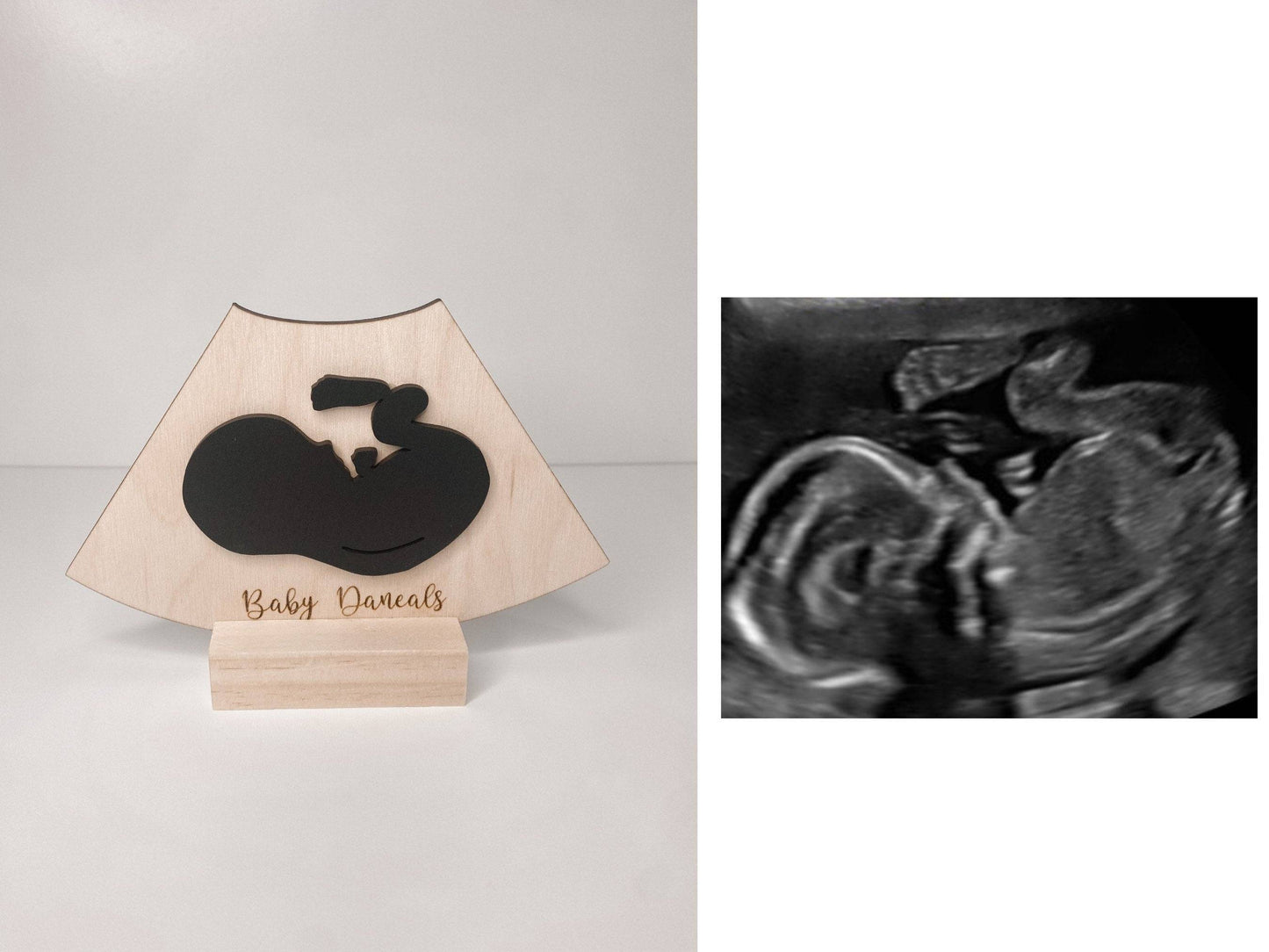 Personalized ultrasound Plaque